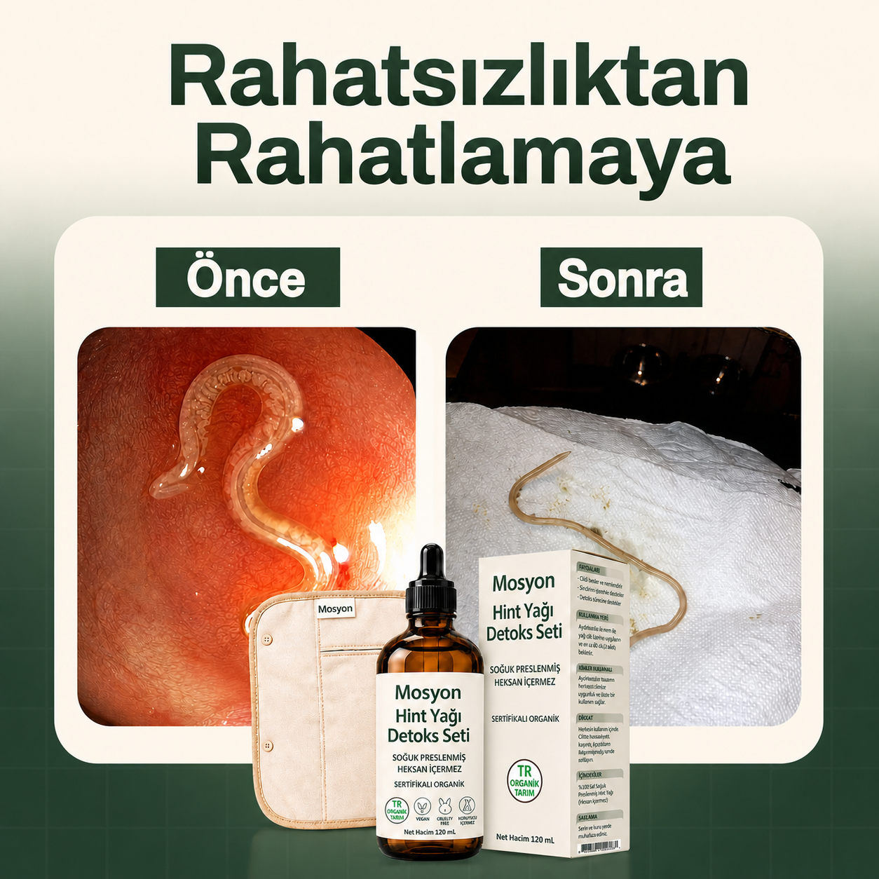 MOSYON® Premium Castor Oil Night Wrap Kit