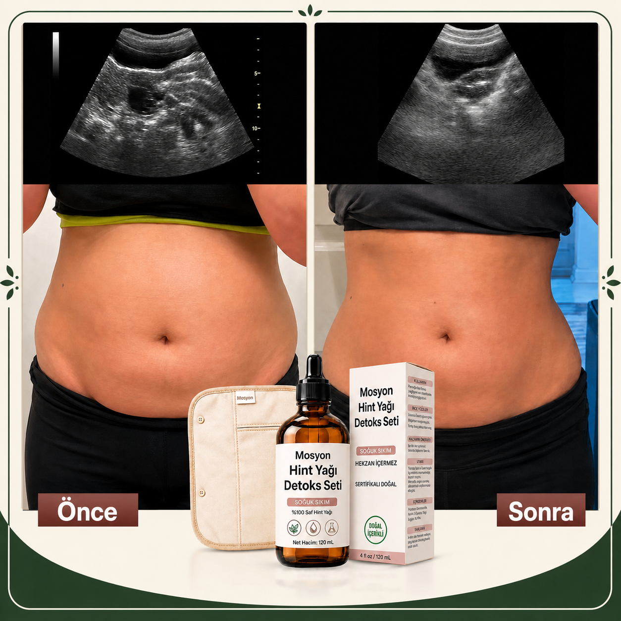 MOSYON® Premium Castor Oil Night Wrap Kit